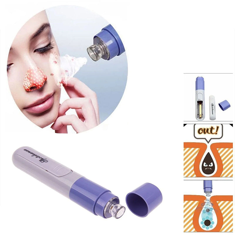 Face Blackhead Remover Facial Pore Cleanser Skin Cleaner Tool - Random Colour